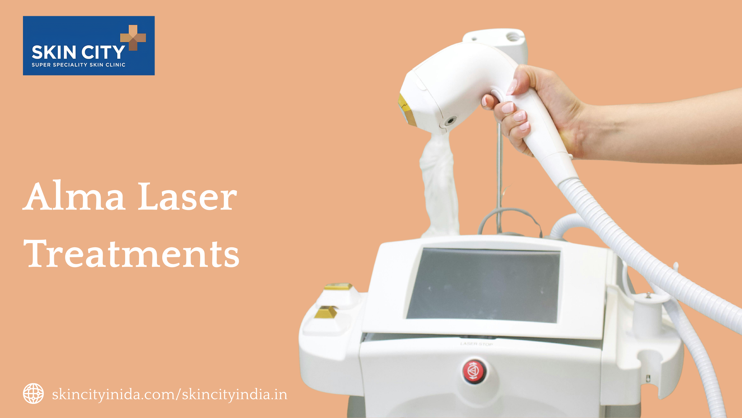Alma laser treatments at SkinCity India