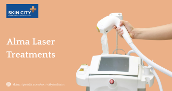 Alma laser treatments at SkinCity India