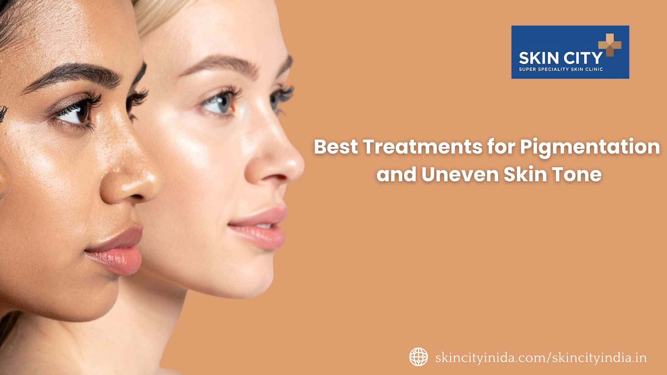 Best Treatments for Pigmentation and Uneven Skin Tone
