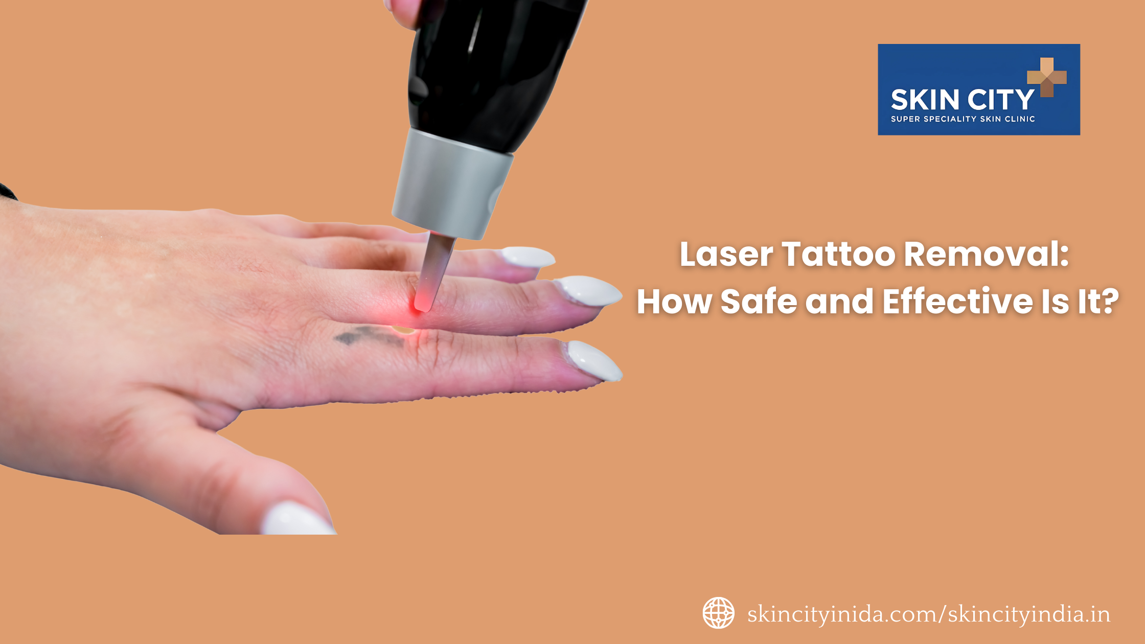 Laser Tattoo Removal: How Safe and Effective Is It?