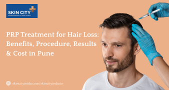 PRP hair treatment in Pune